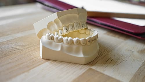 modèle d'étude dentaire en plâtre pour apprendre la numérotation dentaire